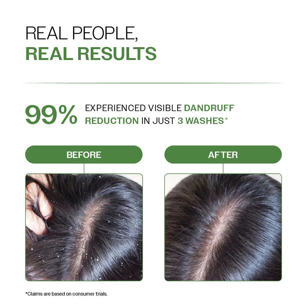 Bare Anatomy Expert Anti-Dandruff Shampoo with Salicylic Acid & Biotin
