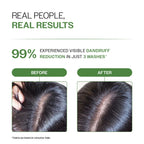 Bare Anatomy Expert Anti-Dandruff Shampoo with Salicylic Acid & Biotin