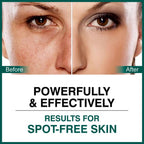 She Essentials Dark Spot Corrector Cream, Niacinamide & Vitamin E Oil