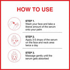 She Essentials Rosehip Face Serum For Tan Pigmentation & Blemish Control