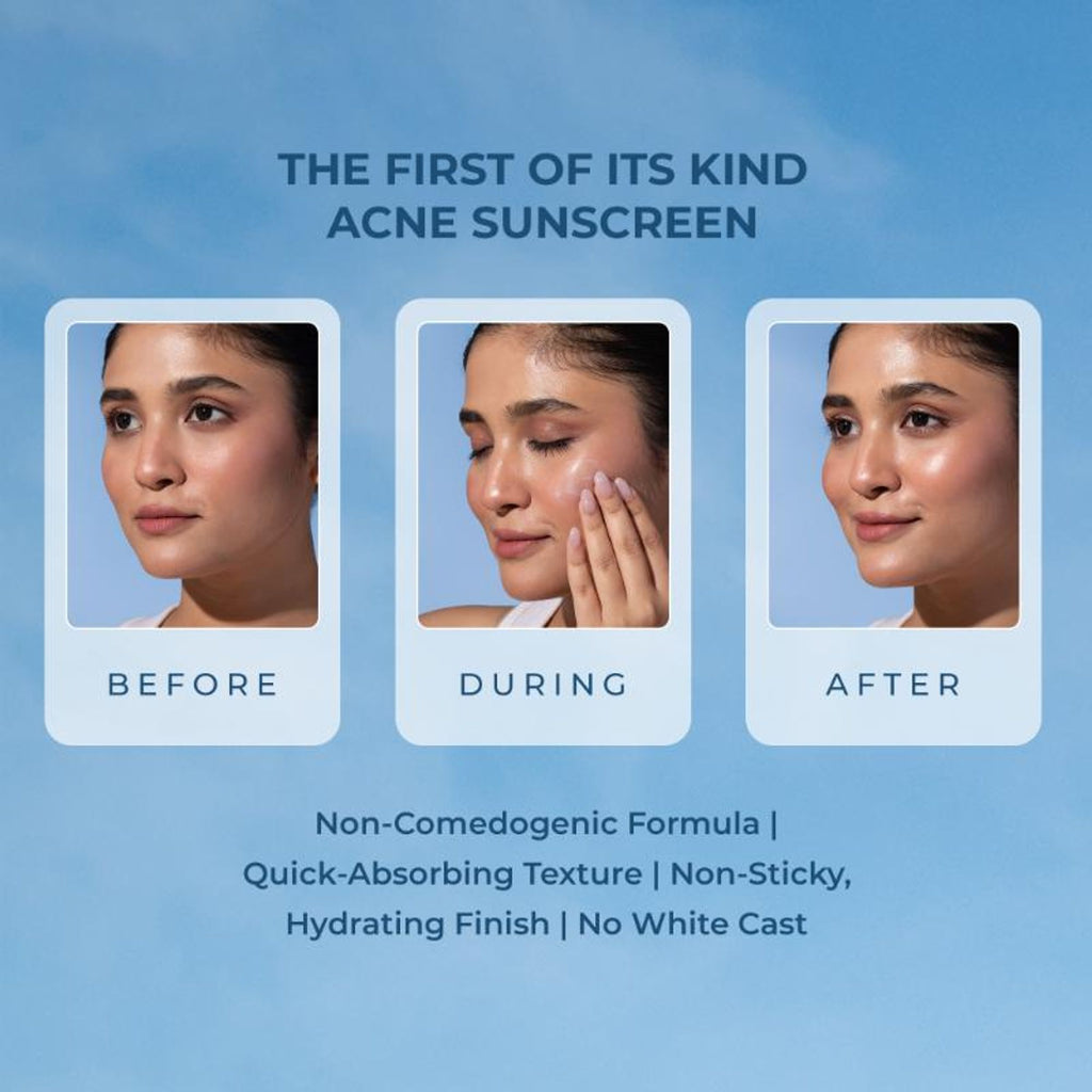 Naturali Acne Control Sunscreen SPF60 With PA+++