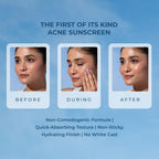 Naturali Acne Control Sunscreen SPF60 With PA+++