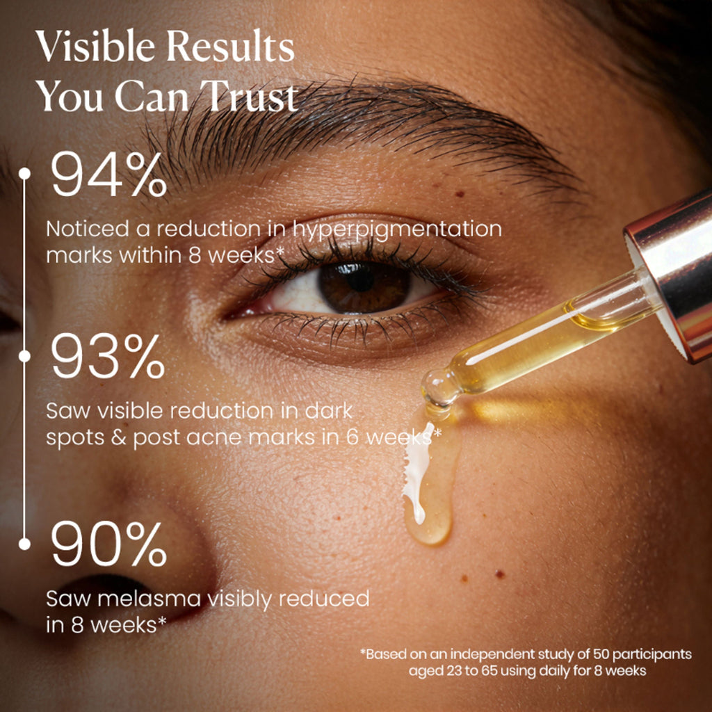 BiE - Beauty In Everything Zero Dark Spot Corrector & Anti-Pigmentation Serum - Distacart