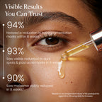 BiE - Beauty In Everything Zero Dark Spot Corrector & Anti-Pigmentation Serum - Distacart