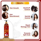 Newish Red Onion Shampoo For Hair Growth & Hair Fall Control