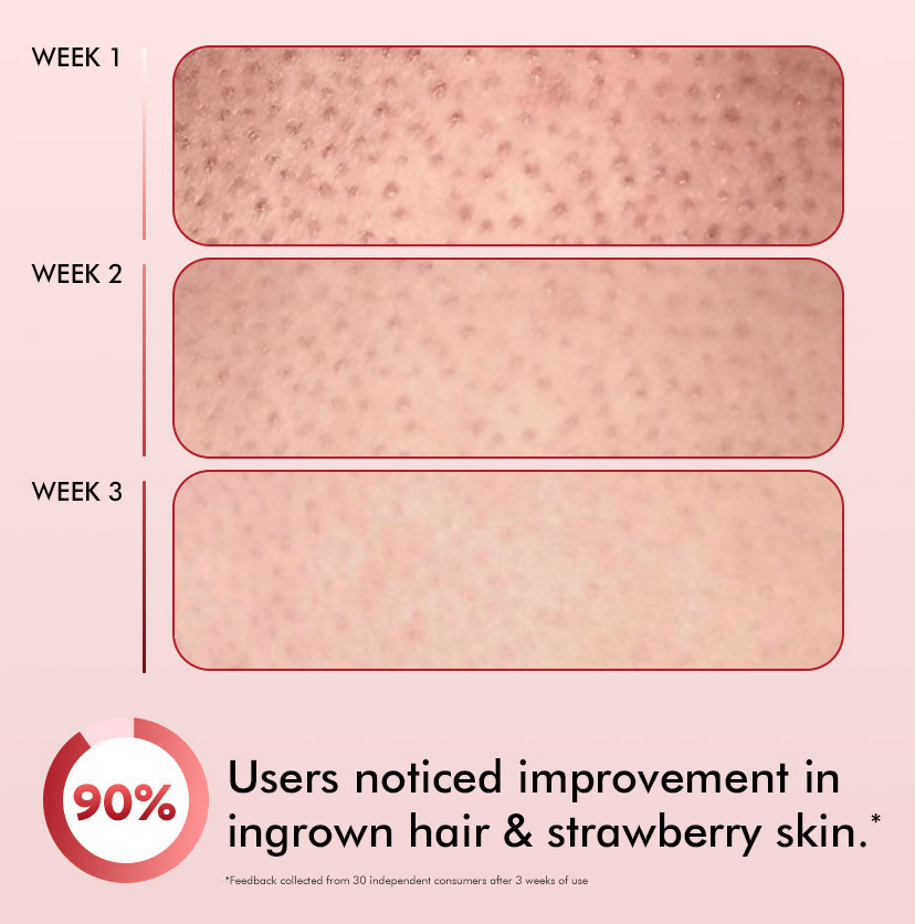 mCaffeine 11% AHA-BHA Skin Smoothening Strawberry Body Lotion