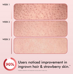 mCaffeine 11% AHA-BHA Skin Smoothening Strawberry Body Lotion