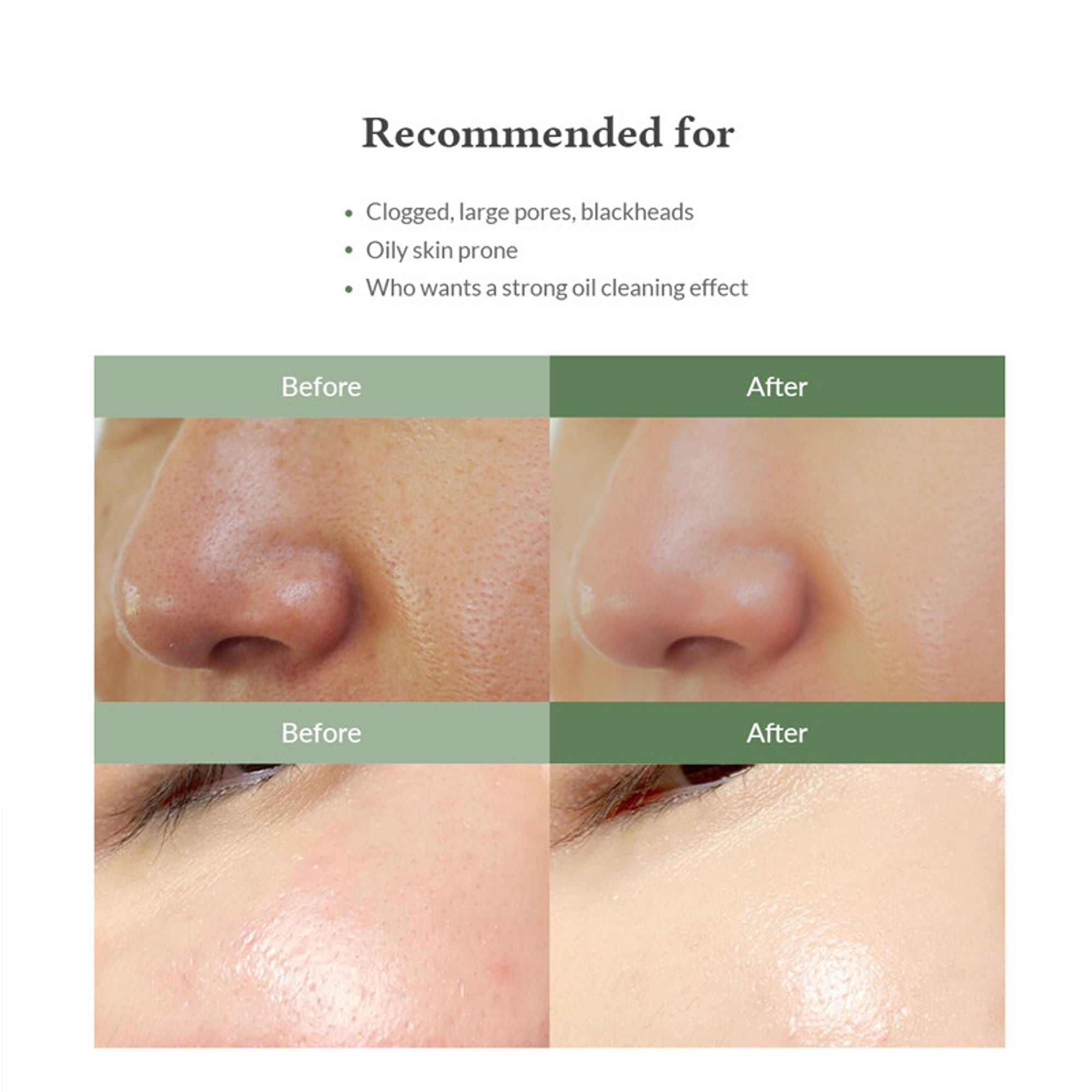 Dr.Althea Premium Sebum Control Cleanser: Deep Pore & Blackhead Cleansing Gel