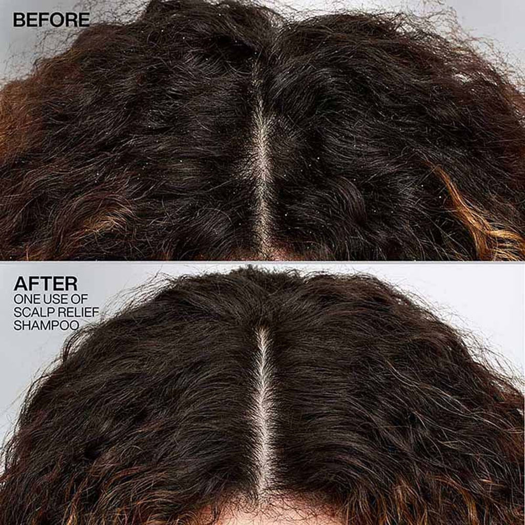 Redken Scalp Relief Anti Dandruff Shampoo For Men & Women