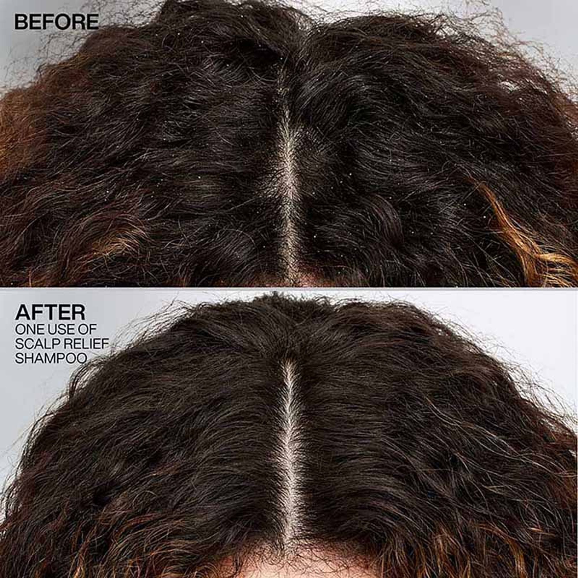 Redken Scalp Relief Anti Dandruff Shampoo For Men & Women