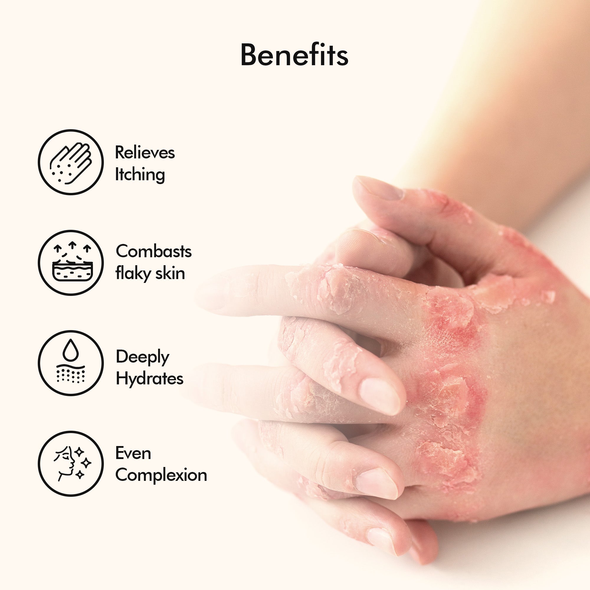 Vedicderm Psoriasis Cream with 2% Bakuchi Extract - Distacart