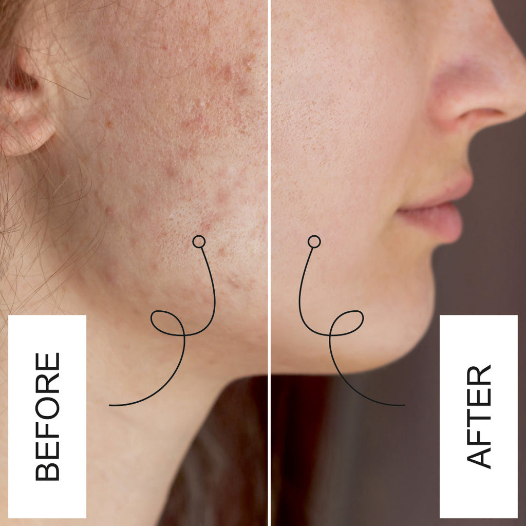 Nuerma Science Kumkumadi Face Oil For Glowing Face