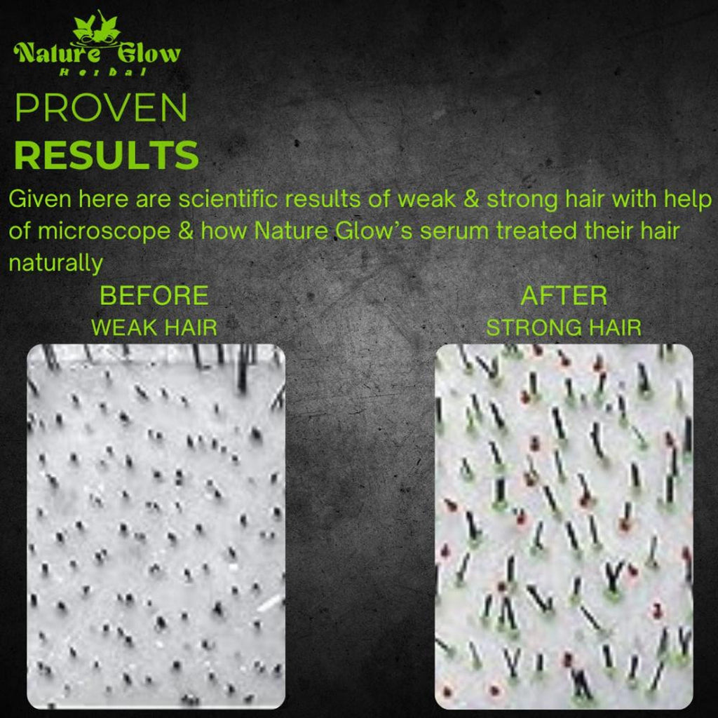 Nature Glow Herbal High Gloss Strengthen Hair Serum