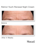 Murad Retinol Youth Renewal Night Cream
