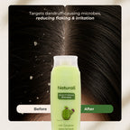 Naturali Dandruff Defence Shampoo with Tea Tree Oil & Cactus Extracts