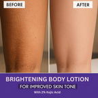 Bake 2% Kojic Acid Body Lotion SPF 30 - Distacart