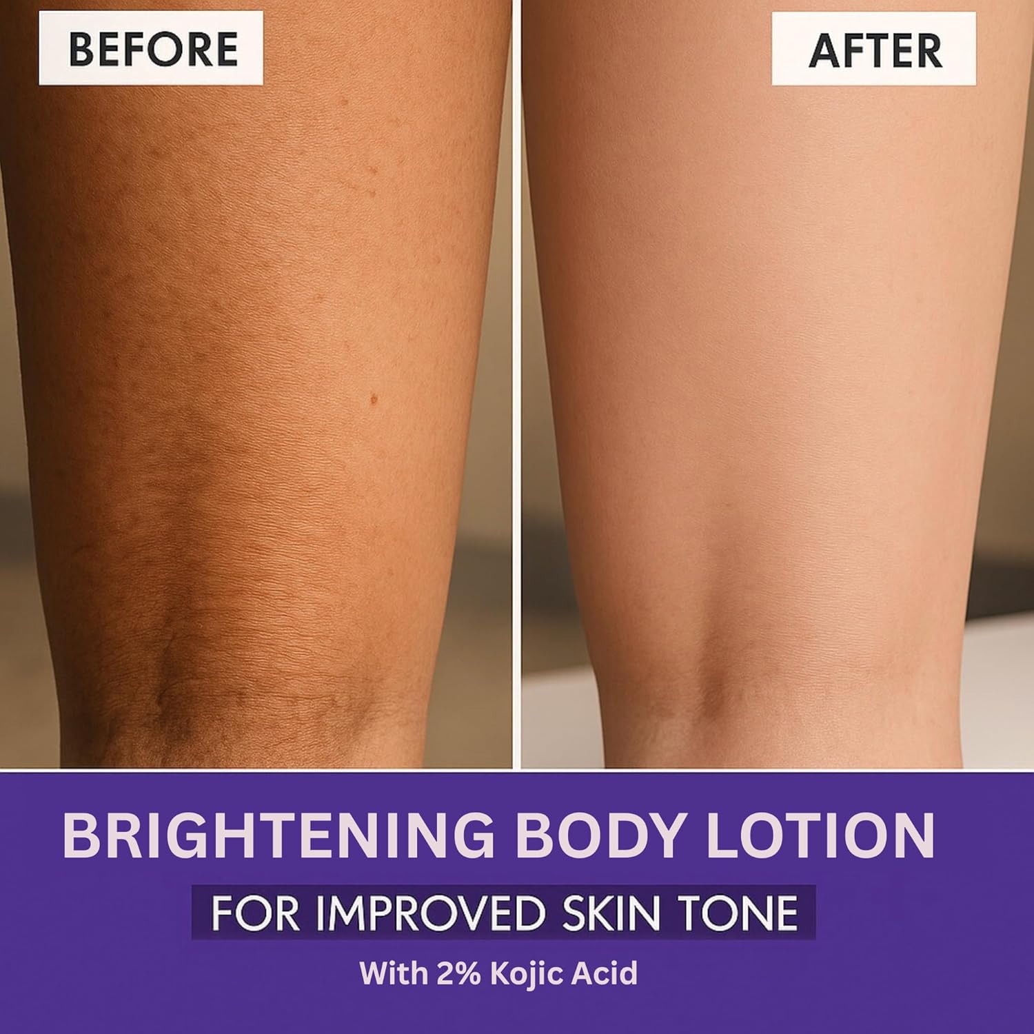 Bake 2% Kojic Acid Body Lotion SPF 30 - Distacart