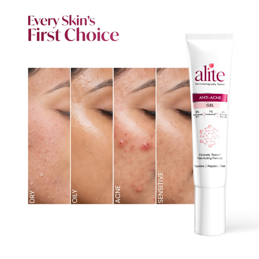 Alite Anti Acne Gel - Distacart