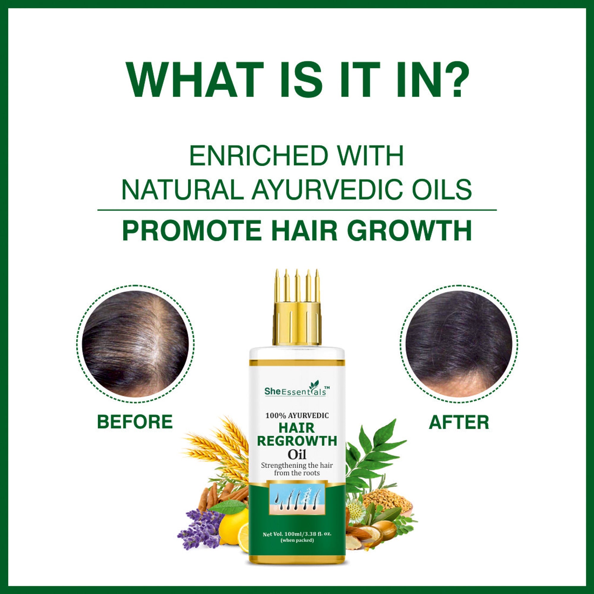 She Essentials Hair Regrowth Oil Infused With Rosemary For Anti Hair Fall & Hair Growth