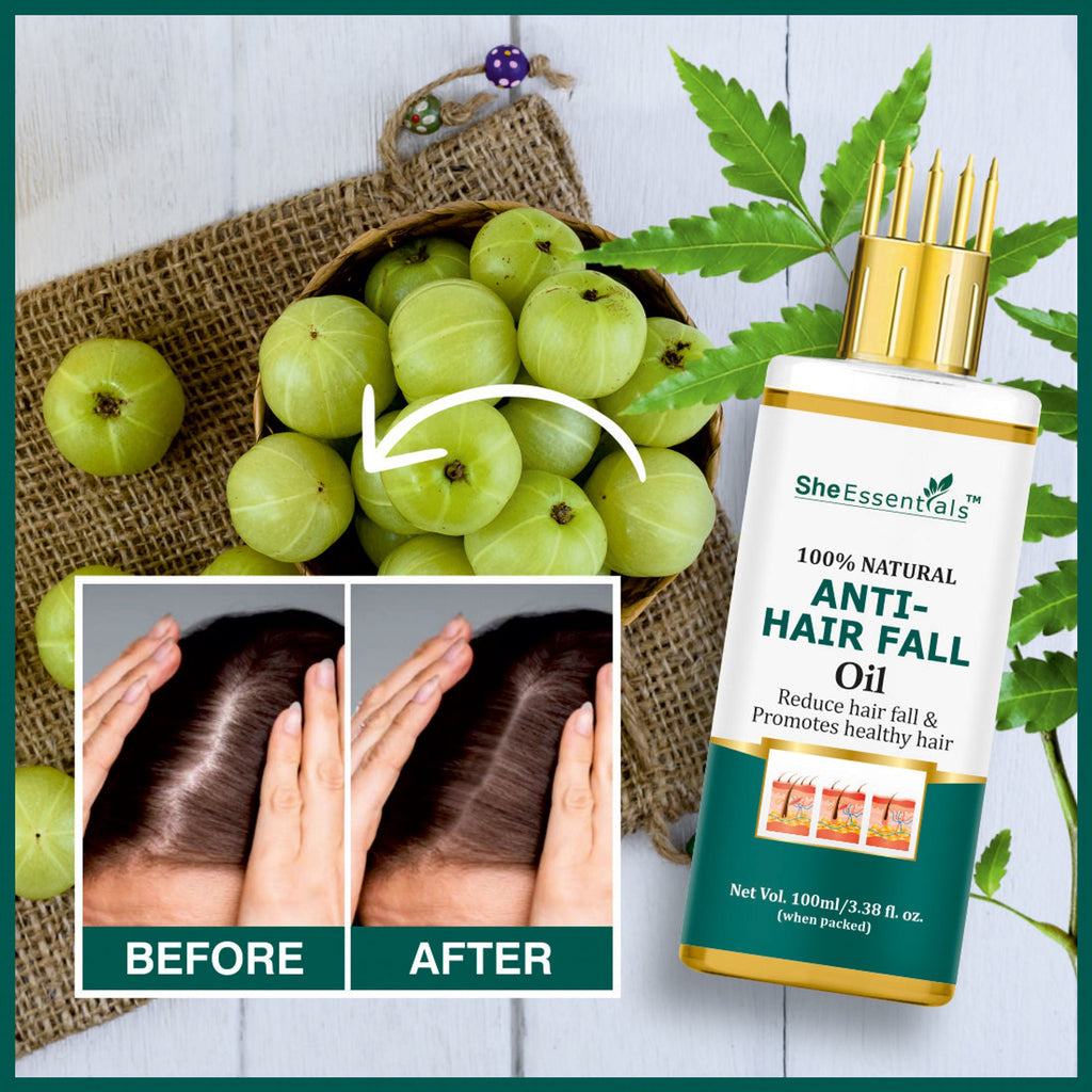 She Essentials Anti Hair Fall & Hair Growthoil For All Types Of Hair