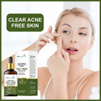 She Essentials Lavender Oil & Tea Tree Essential Oil Combo - Hair & Skincare