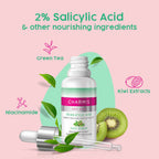 Charmis Anti Acne 2% Salicylic Acid Face Serum with Green Tea & Kiwi Extracts for Clear & Glowing Skin