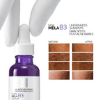 La Roche-Posay Mela B3 Serum, For Anti-Dark Spots & Pigmented Skin with Melasyl + 10% Niacinamide