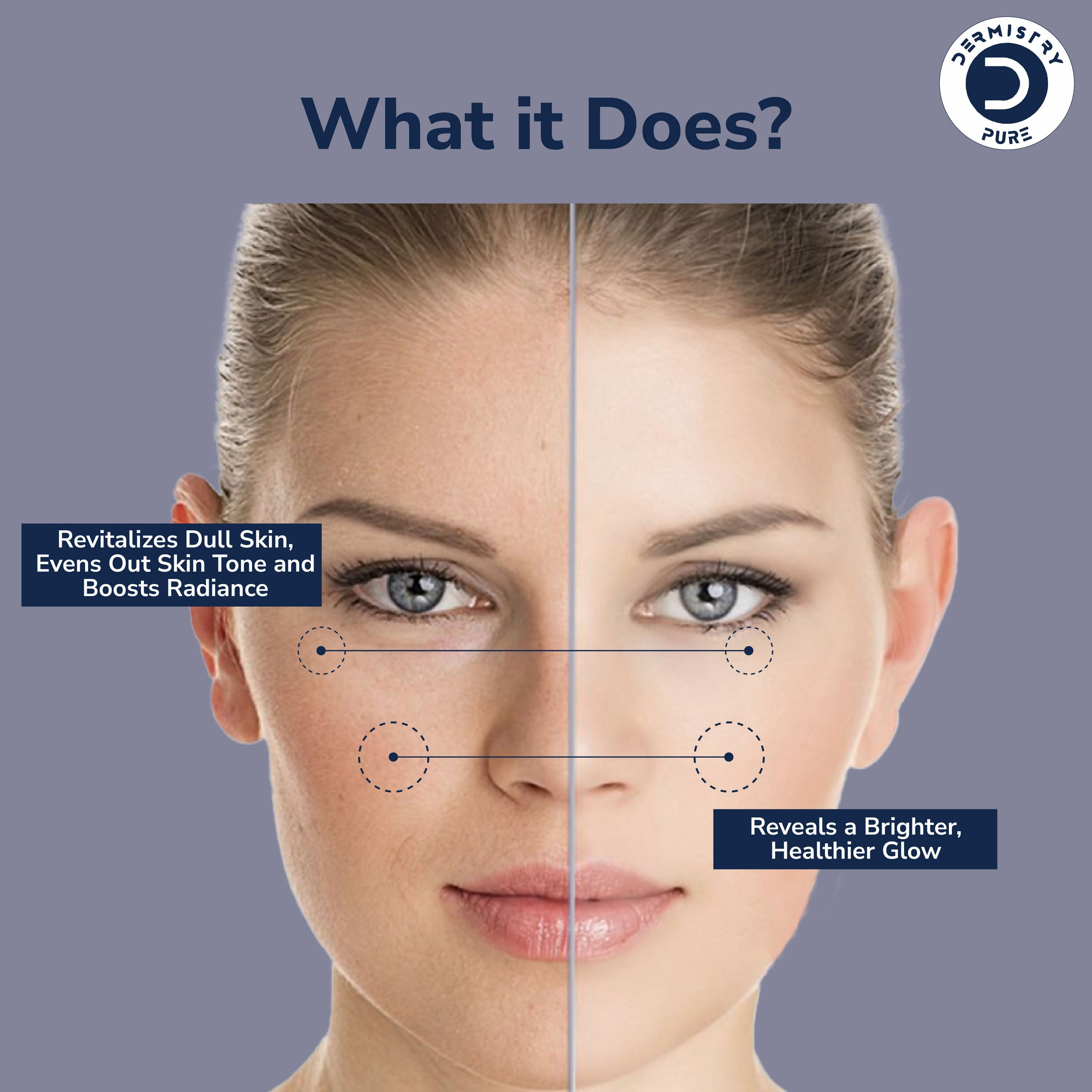 Dermistry 10% Vitamin C 1% Alpha Arbutin Dull Skin Brightening Lightening Fairness Glow Face Serum