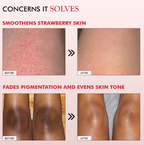mCaffeine 11% AHA-BHA Skin Smoothening Strawberry Body Lotion