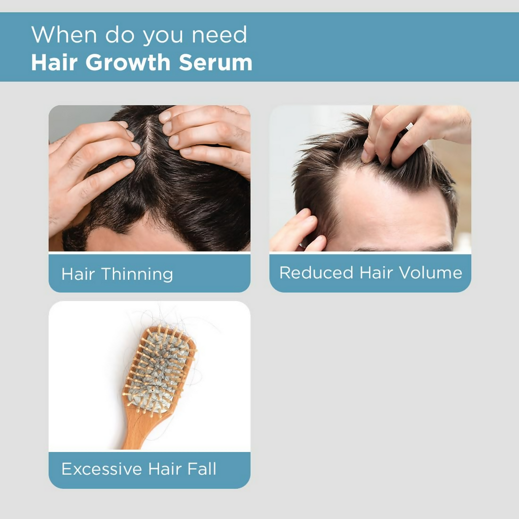 The Man Company Hair Growth Serum For Man - Distacart