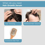 The Man Company Hair Growth Serum For Man - Distacart