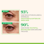 Murad Retinol Youth Renewal Eye Serum