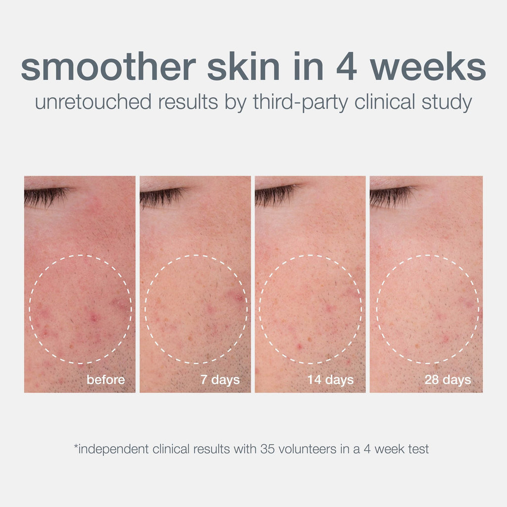 Dermalogica Daily Microfoliant Face Scrub