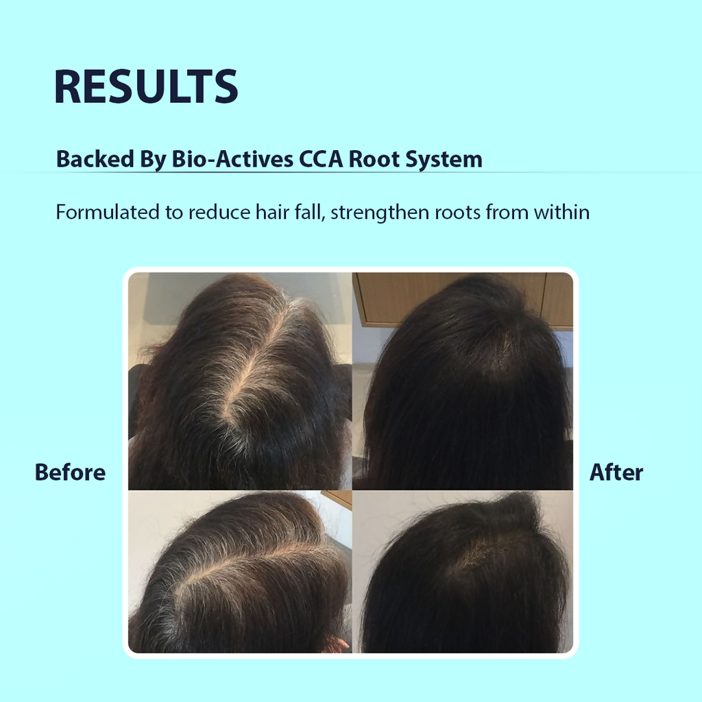 Dermistry Follicusan Hairgenyl & Caffeine Anti Hair Fall Control Serum Mask & Shampoo - Distacart