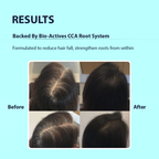 Dermistry Follicusan Hairgenyl & Caffeine Anti Hair Fall Control Serum Mask & Shampoo - Distacart