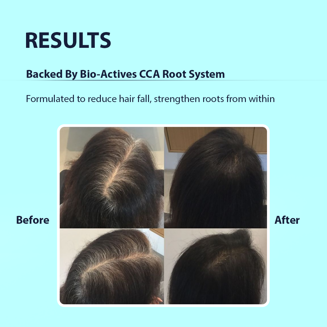 Dermistry Follicusan Hairgenyl & Caffeine Anti Hair Fall Control Serum Mask & Shampoo - Distacart