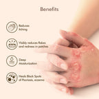 VedicDerm Oleander's Oil for Psoriasis, Eczema, and Atopic Dermatitis - Distacart