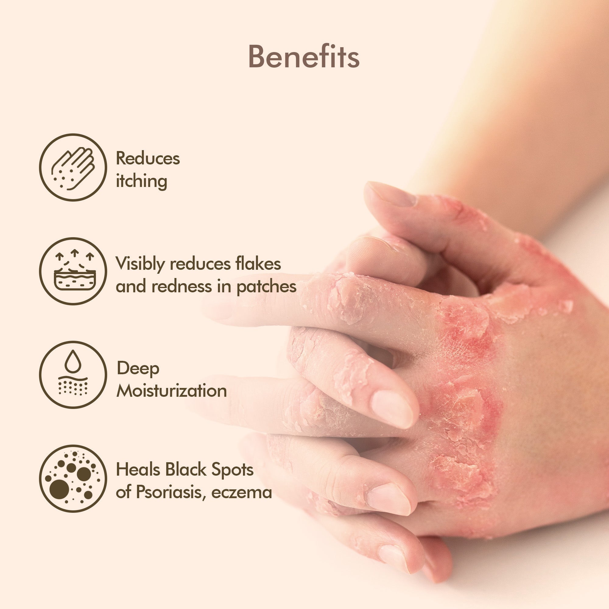 VedicDerm Oleander's Oil for Psoriasis, Eczema, and Atopic Dermatitis - Distacart