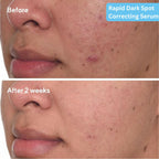 SkinLuv Dark Spot Correcting Serum