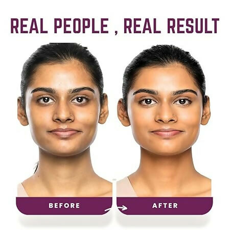 Our Cares Face Cream with Hyaluronic Acid & Vitamin E