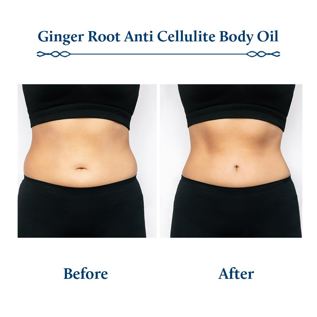 Blue Nectar Ginger Oil Anti Cellulite Body Massage Oil - Distacart