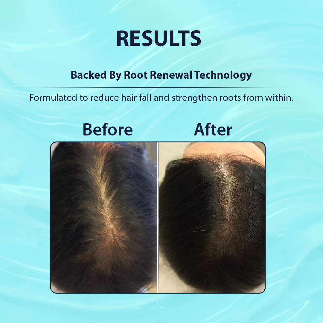 Dermistry Follicusan Hairgenyl & Caffeine Anti Hair Fall Control Serum & Shampoo - Distacart