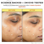 Hyphen By Kriti Sanon 10% Vitamin C, 1% Vitamin E & Ferulic Acid Serum - Distacart
