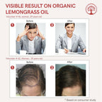 Ivory Natural Organic Lemongrass Oil Pure & Premium Essential Oil For Face, Scalp & Skin