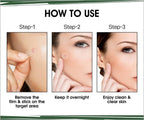 Urban Yog Acne Pimple Patch - Limited Time Offer