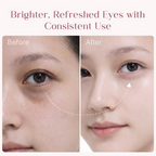 Seoulskin Under Eye Cream - Distacart