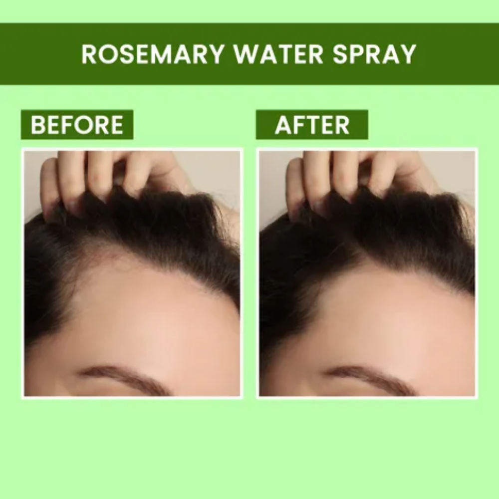 Alps Goodness X DERMDOC Bestselling Sprays Duo