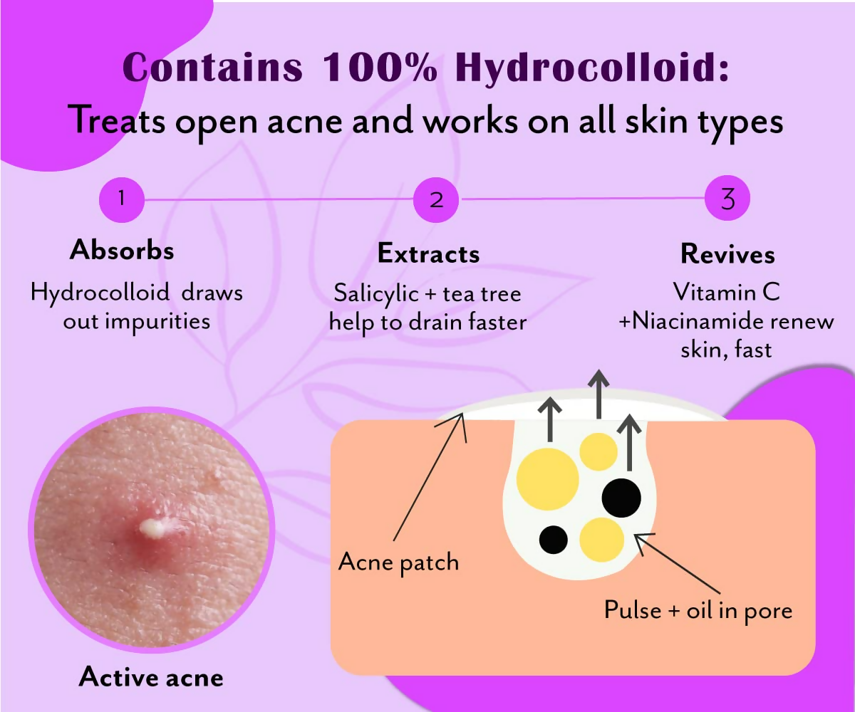 Urban Yog Acne Pimple Patch - Invisible Facial Stickers Cover With 100% Hydrocolloid