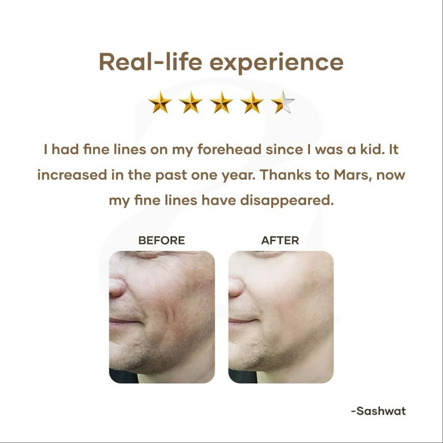 Mars By GHC Anti Aging Serum With Retinol - Distacart