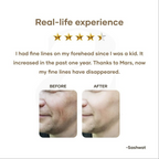 Mars By GHC Anti Aging Serum With Retinol - Distacart